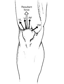 Figure 2) Because the quadriceps muscle has four heads (hence the name quadriceps), each section exerts a pull with a different line of drive. The vastus lateralis (VL) creates a powerful lateral pull, while the rectus femoris (RF) and vastus intermedius (VI) produce almost a straight pulling force. The lateral pull of the vastus lateralis must be resisted by the inward pull of the vastus medialis (VM). The lower portion of the vastus medialis is referred to as the vastus medialis obliquus or VMO.