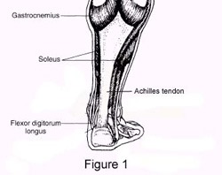 Abbildung 1: Musculus gastrocnemius und Musculus soleus verbinden sich zur dicken Achillessehne.
